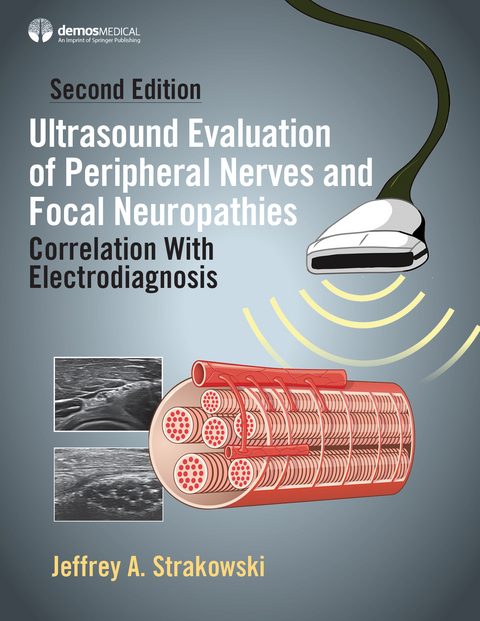 Ultrasound Evaluation of Peripheral Nerves and Focal Neuropathies, Second Edition -  MD Jeffrey A. Strakowski