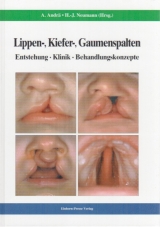 Lippen-, Kiefer-, Gaumenspalten - Hans-Joachim Neumann