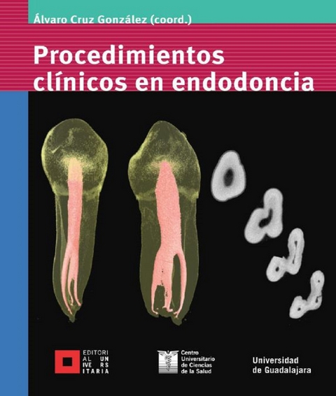 Procedimientos clínicos en endodoncia - Álvaro Cruz González, Ana Rosa Barragán Tejeda, Carlos E. Bracamontes Campoy, Octavio Amezcua Gutiérrez, María Guadalupe Sánchez Antillón, Leobardo Santiago Ruvalcaba Muñoz, Hugo Isaac Contreras Plascencia, Martín Barajas Rodríguez, Francisco Yáñez López, Mario Uribe Campero, Norberto Broon Juárez, Martín Javier Chávez Brito, Diana Citlalli García Ramírez, Hilda Patricia Cholico Rodríguez, L. Gerardo Gascón Guerra, Celin A. de León Aguayo, Carlos Guerrero Bobadilla