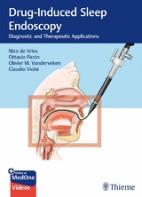 Drug-Induced Sleep Endoscopy - 