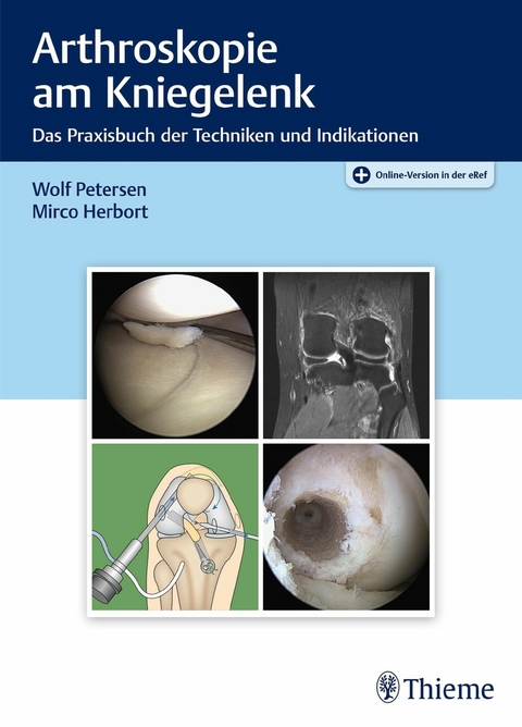 Arthroskopie am Kniegelenk -  Wolf Petersen,  Mirco Herbort