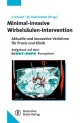 Minimalinvasive Wirbelsäulen-Intervention - 