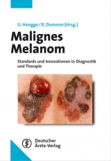 Malignes Melanom - Ulrich R Hengge, Reinhard Dummer