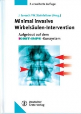 Minimal-Invasive Wirbelsäulen-Intervention - Jerosch, Jörg; Steinleitner, Werner