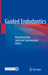 Guided Endodontics - 