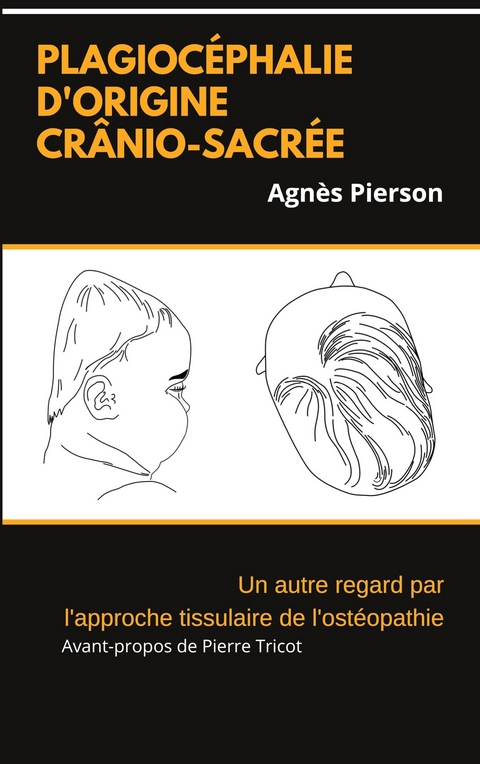 plagiocéphalie d'origine crânio-sacrée - Agnès Pierson