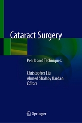 Cataract Surgery - 