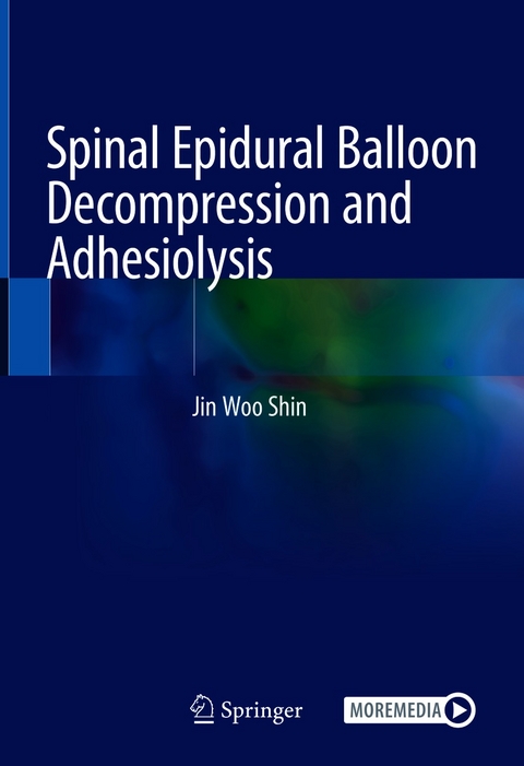 Spinal Epidural Balloon Decompression and Adhesiolysis -  Jin Woo Shin