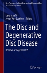 The Disc and Degenerative Disc Disease - 