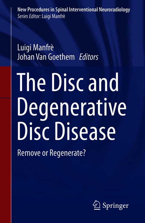 The Disc and Degenerative Disc Disease - 