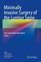 Minimally Invasive Surgery of the Lumbar Spine - 