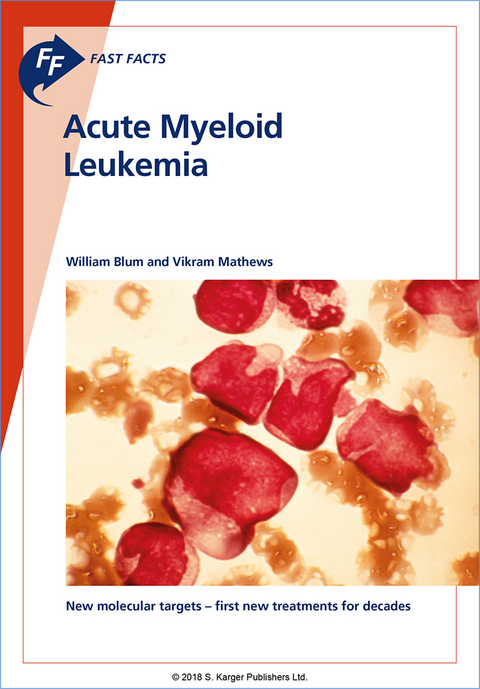 Fast Facts: Acute Myeloid Leukemia - W. Blum, V. Mathews