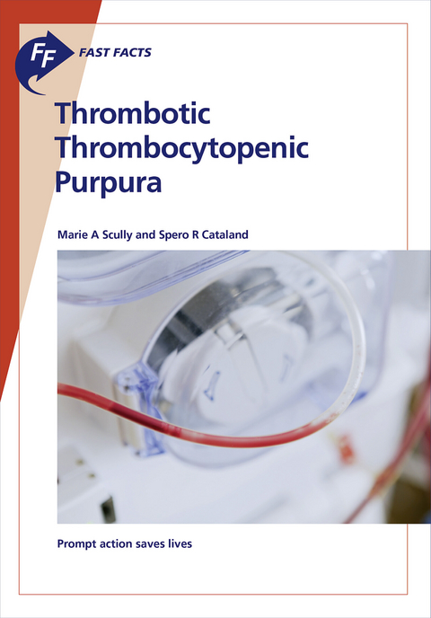 Fast Facts: Thrombotic Thrombocytopenic Purpura - M.A. Scully, S.R. Cataland