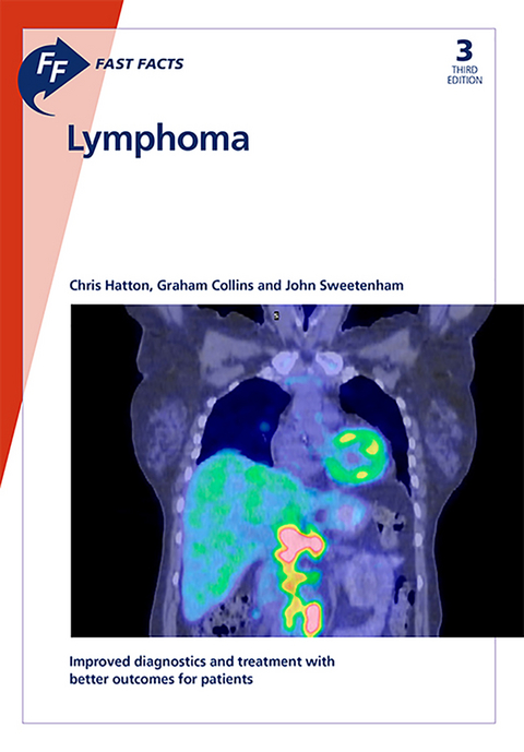 Fast Facts: Lymphoma - C. Hatton, G. Collins, J. Sweetenham