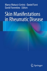 Skin Manifestations in Rheumatic Disease - 