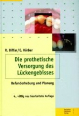 Die prothetische Versorgung des Lückengebisses - Biffar, Reiner; Körber, Erich