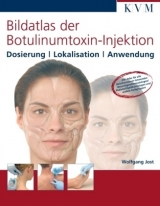 Bildatlas der Botulinumtoxin-Injektion - Wolfgang Jost