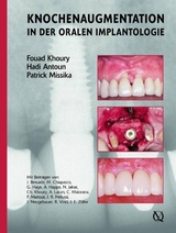 Augmentive Verfahren in der oralen Implantogie - Fouad Khoury