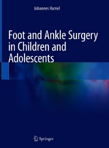 Foot and Ankle Surgery in Children and Adolescents -  Johannes Hamel