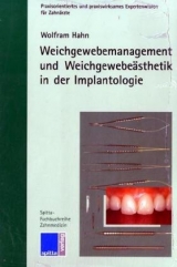 Weichgewebemanagement und Weichgewebeästhetik in der Implantologie - Wolfram Hahn