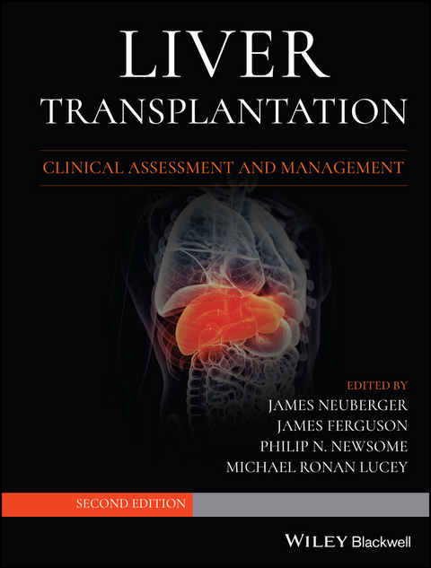 Liver Transplantation - 