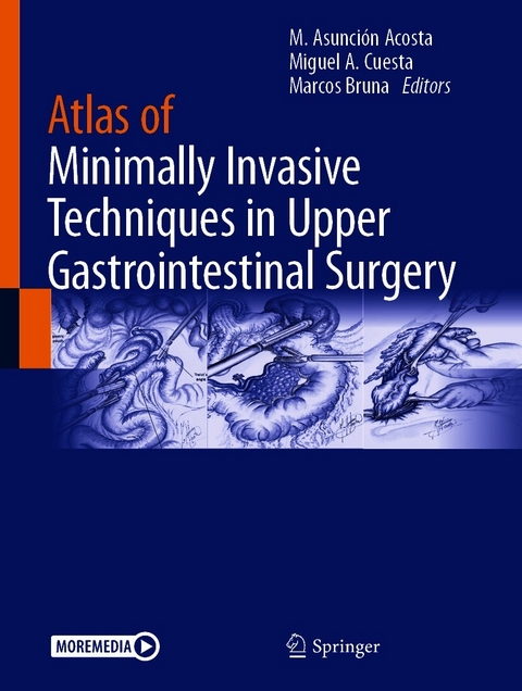 Atlas of Minimally Invasive Techniques in Upper Gastrointestinal Surgery - 