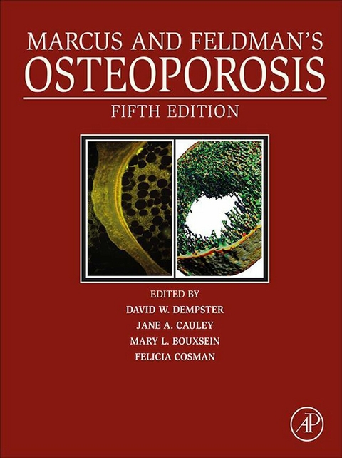 Marcus and Feldman's Osteoporosis - 