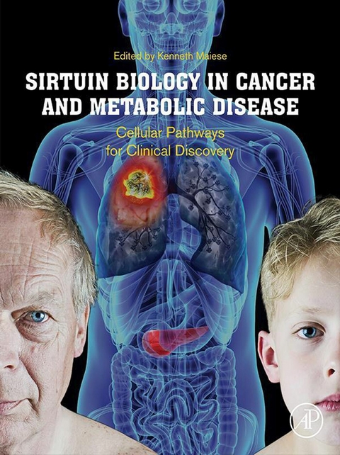 Sirtuin Biology in Cancer and Metabolic Disease - 