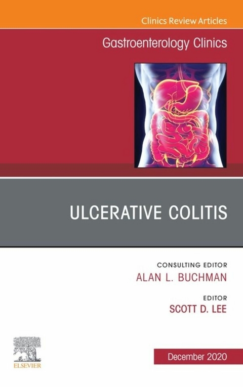 Ulcerative Colitis, An Issue of Gastroenterology Clinics of North America, E-Book - 