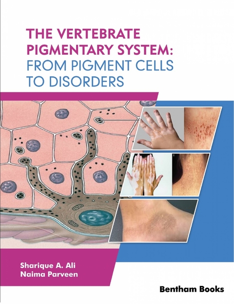 The Vertebrate Pigmentary System: From Pigment Cells to Disorders - 