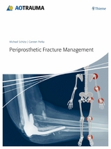 Periprosthetic Fracture Management - Michael Schütz, Carsten Perka