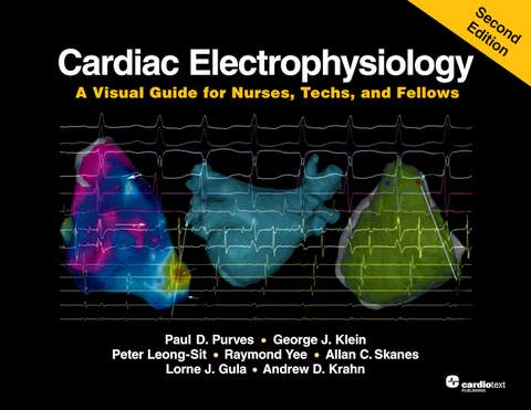 Cardiac Electrophysiology: A Visual Guide for Nurses, Techs, and Fellows, Second Edition -  Lorne J. Gula,  George J. Klein,  Andrew D. Krahn,  Peter Leong-Sit,  Paul D. Purves,  Allan C. Skanes,  Raymond Yee
