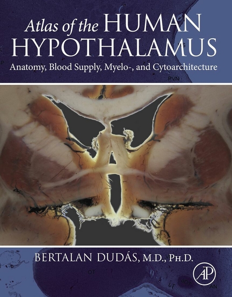 Atlas of the Human Hypothalamus -  Bertalan Dudas