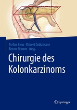 Chirurgie des Kolonkarzinoms - 