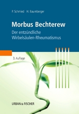 Morbus Bechterew - Schmied, Paul; Baumberger, Heinz