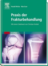 Praxis der Frakturbehandlung - Ronald McRae, Max Esser