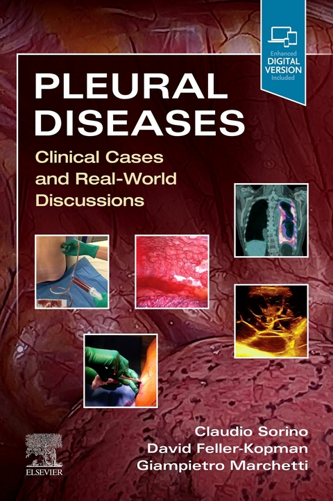 Pleural Diseases - 