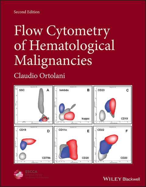 Flow Cytometry of Hematological Malignancies -  Claudio Ortolani