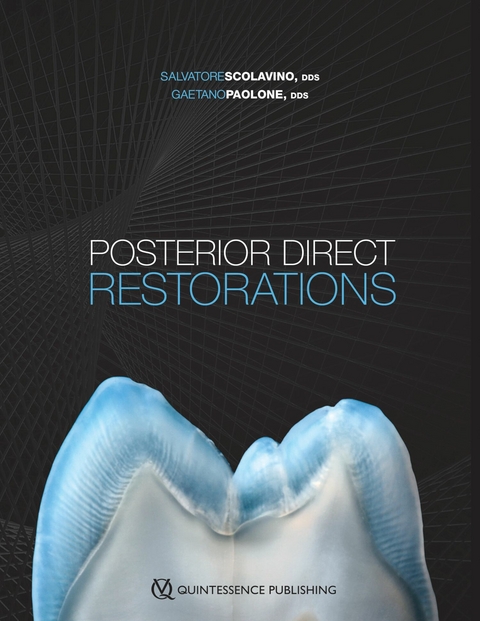 Posterior Direct Restorations - Salvatore Scolavino, Gaetano Paolone