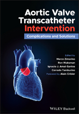 Aortic Valve Transcatheter Intervention - 
