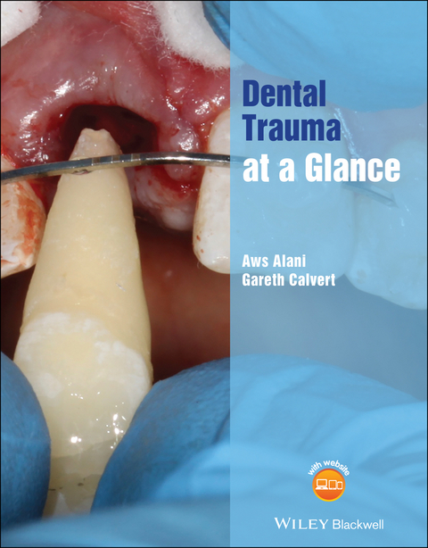 Dental Trauma at a Glance -  Aws Alani,  Gareth Calvert