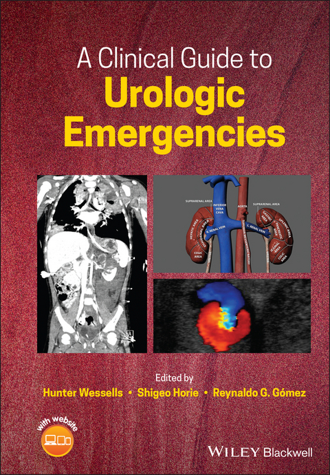 Clinical Guide to Urologic Emergencies - 