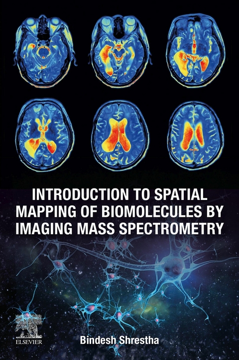 Introduction to Spatial Mapping of Biomolecules by Imaging Mass Spectrometry -  Bindesh Shrestha