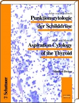 Aspiration Cytology of the Thyroid - 