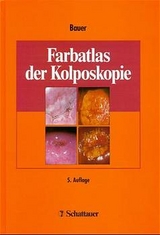 Farbatlas der Kolposkopie - Bauer, Hanskurt