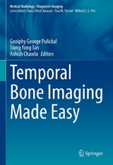 Temporal Bone Imaging Made Easy - 