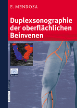 Duplexsonographie der oberflächlichen Beinvenen - Erika Mendoza