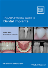 ADA Practical Guide to Dental Implants -  J. Anthony von Fraunhofer,  Luigi O. Massa