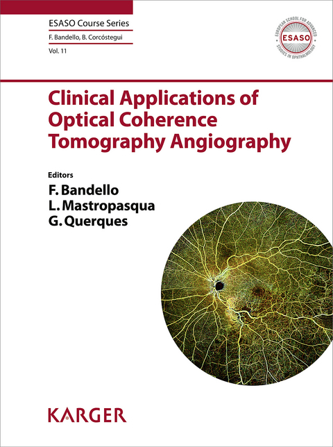 Clinical Applications of Optical Coherence Tomography Angiography - 