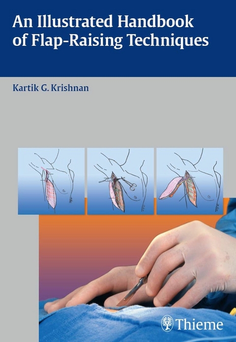 An Illustrated Handbook of Flap-Raising Techniques -  Kartik G. Krishnan